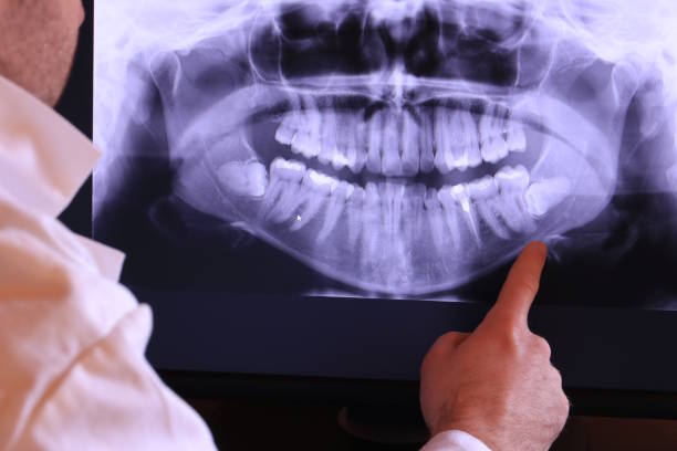 Best Emergency Dentist for Lost Fillings or Crowns in Countryside, IL