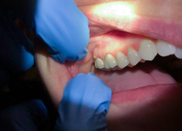 Best Emergency Dental Services for Seniors in Countryside, IL
